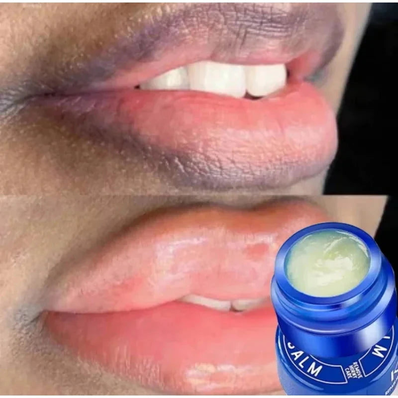 Dark Lip Corrector Balm – Aloe Repair Mask for Lightening Pigmentation & Moisturising Lips (Blue Jar)